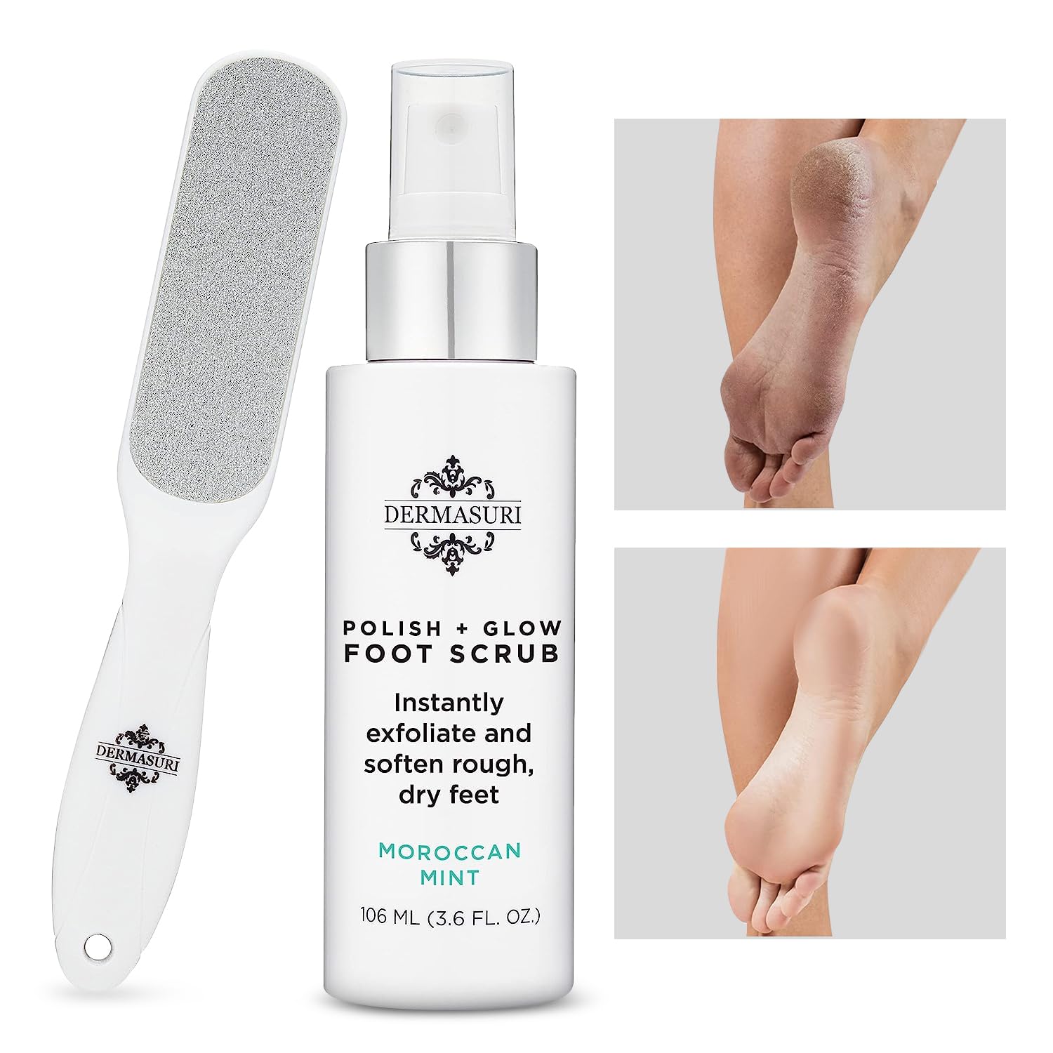 Dermasuri Callus Remover Foot Scrub - Exfoliating Feet Spray-on Formula and Reusable Deluxe Foot File - Dead Skin Remover, Callus Rasp, Scrubber, Peel & Soften Cracked Heels - Deluxe Pedicure Spa Kit